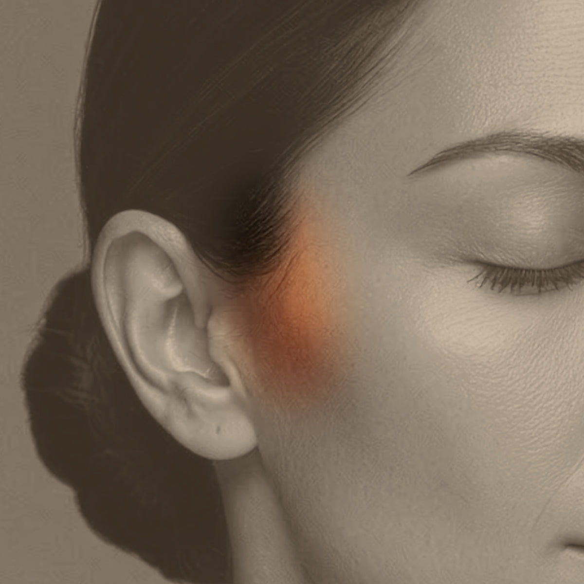 Close-up of the sideburns treatment area for laser hair removal at Bare Beauty Collective in Suffern, NY